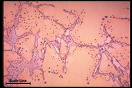 Microstructure
